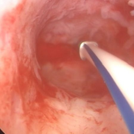 FibroPlant FibroPlant