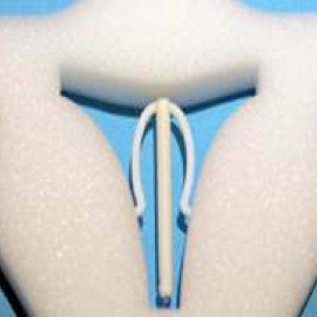 Omega-shaped IUS Omega-shaped IUS